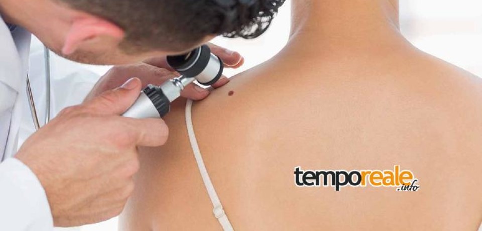 Fondi / Giornata di screening gratuito contro il melanoma e altri tumori cutanei