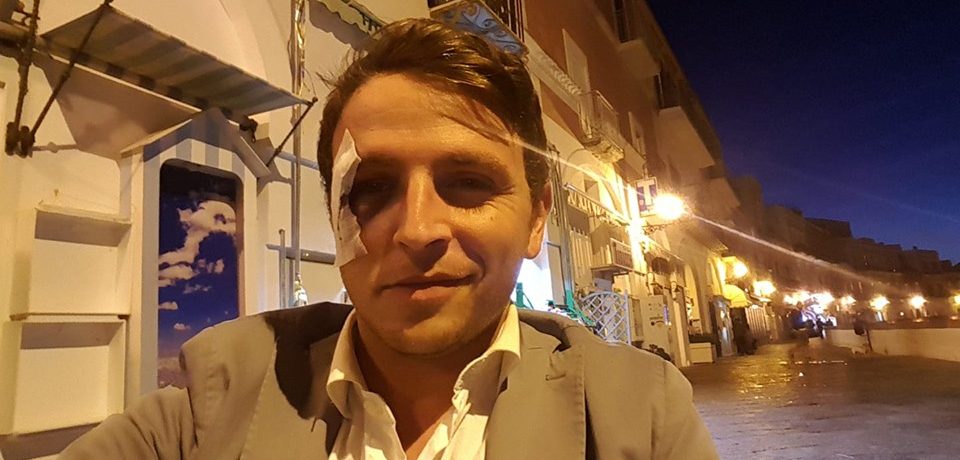 Ponza / Aggressione a Danilo D’Amico, la minoranza chiede incontro con il Prefetto