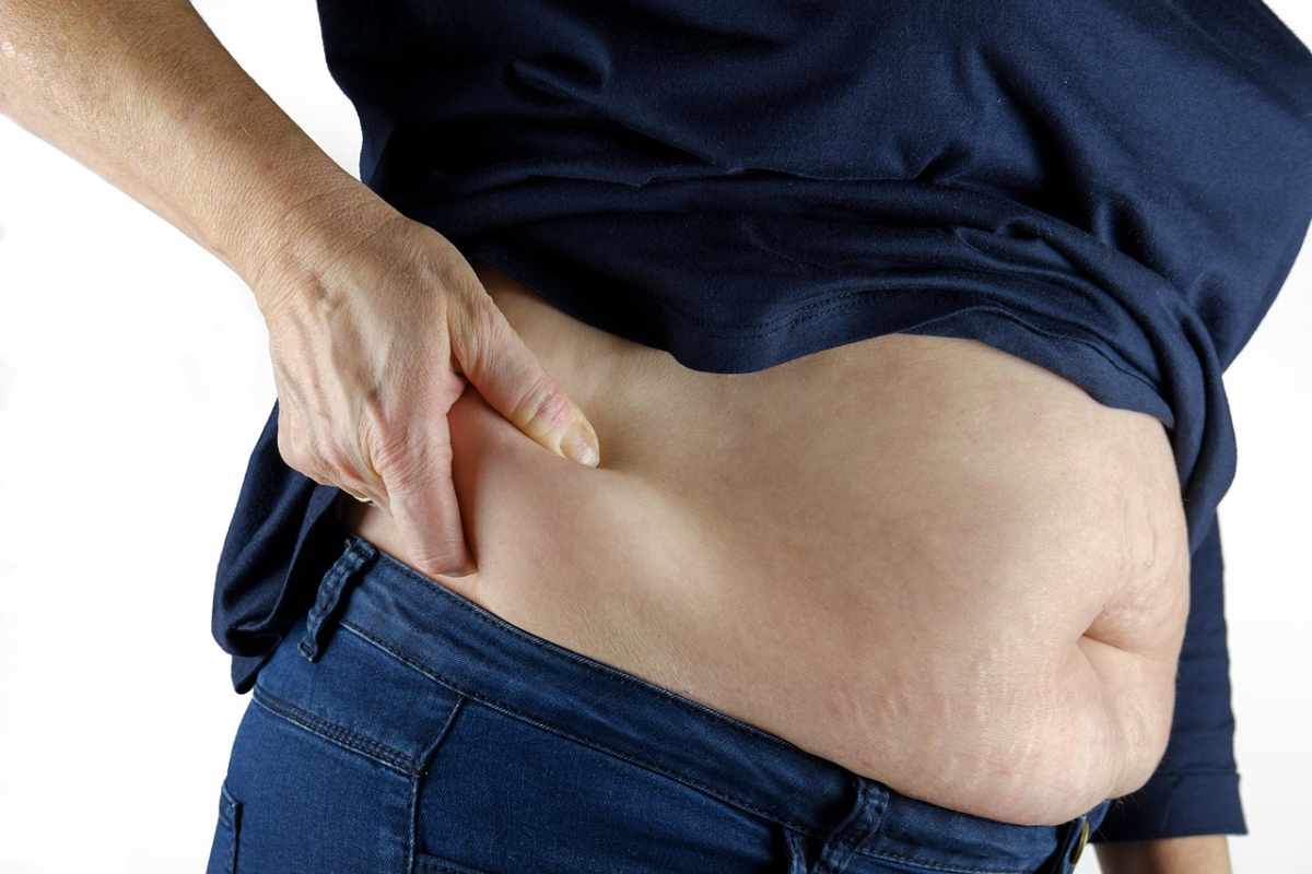 persona obesa