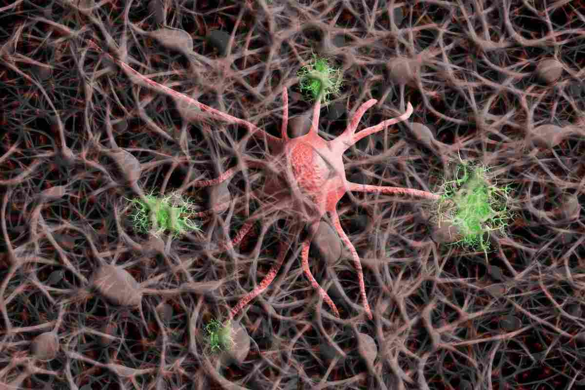 Il tanto maltrattato zucchero è diventato chiave per la cura dell’Alzheimer: la scoperta che rivoluziona la medicina Il tanto maltrattato zucchero è diventato chiave per la cura dell’Alzheimer: la scoperta che rivoluziona la medicina